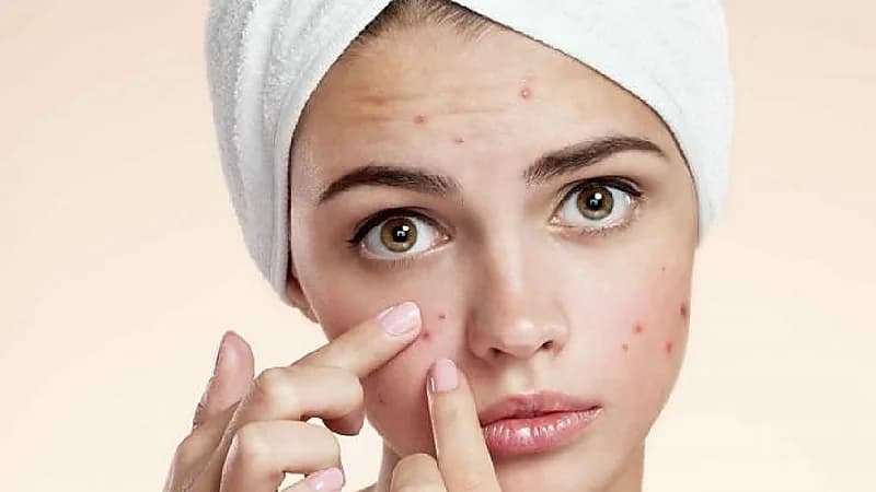 بالفيديو.. أخصائية: جلسات تحفيز إنتاج الكولاجين مفيدة للمقبلات على الزواج