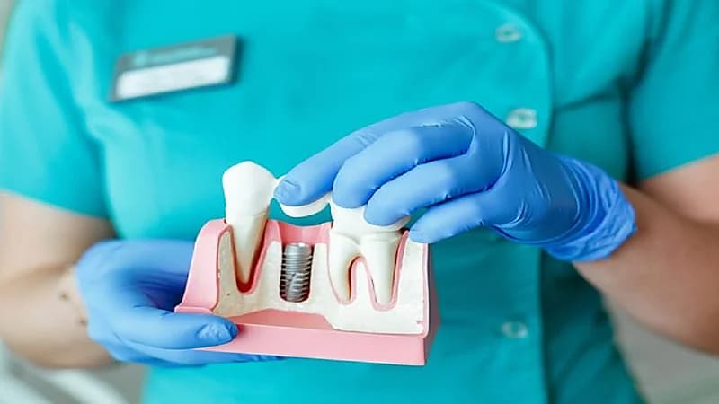 بالفيديو.. محامي: يحق للمتضرر من إعلانات عيادات زراعة الأسنان رفع دعوى