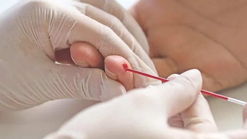 للمصابين بفقر دم.. احذروا ممارسة الرياضة الهوائية