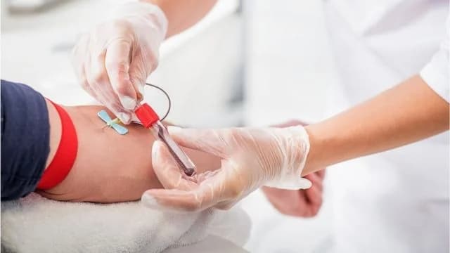 خطوات يجب القيام بها قبل التبرع بالدم وبعده .. فيديو
