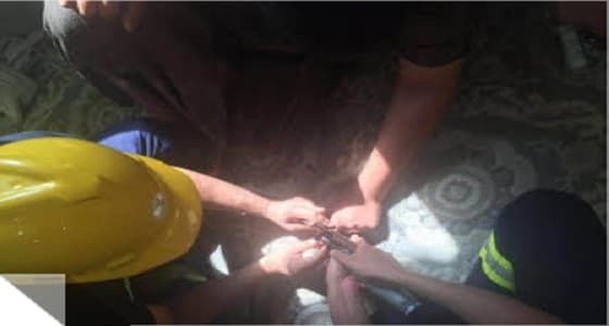 الدفاع المدني يزيل خاتم احتبس في يد رجل بجدة