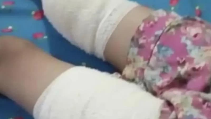 كلاب ضالة تهاجم طفلة وتنهش فخذيها في سوق جازان