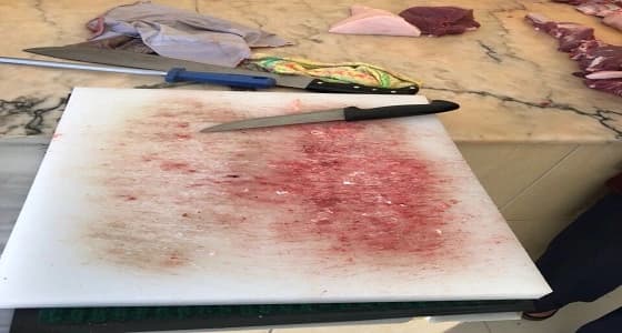 بالصور.. ضبط مخالفات صحية في إحدى الملاحم