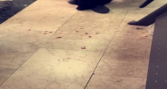 وقوع مضاربة جماعية بين طالبات باستخدام المشارط في جامعة الطائف