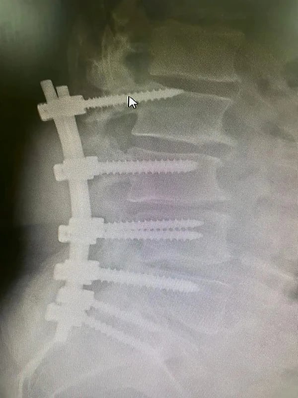 شاهد.. لحظة اقتحام سيارة لصيدلية وتحطيم واجهتها الزجاجية في المدينة