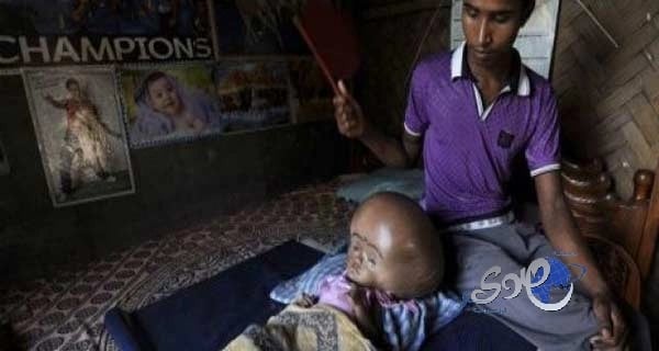 عملية قلب مفتوح تعيد النبض لخمسيني في نجران