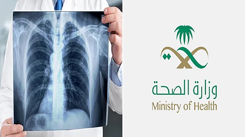 وزارة الصحة توجه نصائح لمرضى السل