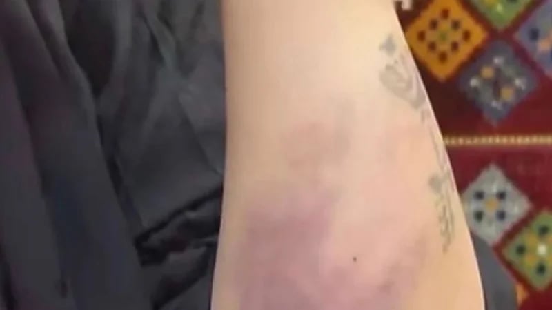 "العنف الأسري" يباشر الواقعة المتداولة حول تعرُّض امرأة للتعنيف