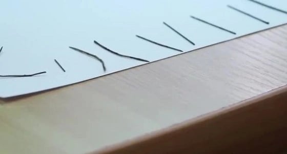 بالصور..رضيع يبتلع 16 إبرة