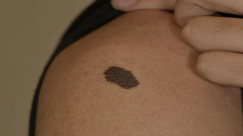 امرأة تكتشف خيانة زوجها مع صديقتها بسبب "وحمة"