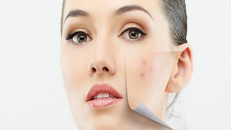 طرق الوقاية من إصابة البشرة بالبقع الداكنة