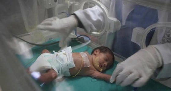 مواطنة تتهم مستشفى بجازان بالتسبب في وفاة رضيعها