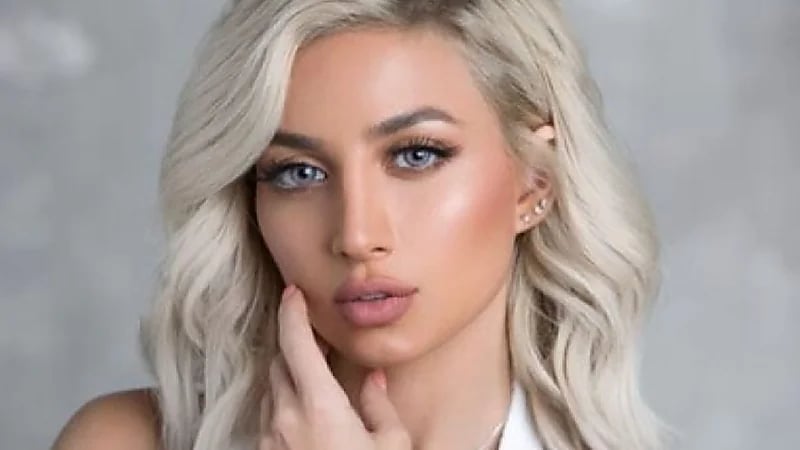 مودل روز عن اتهام طليقها بضربه : " وجه متنفخ من عملية زراعة الشعر"