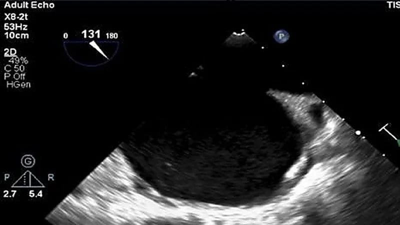 إنقاذ حياة مريضة حامل تعاني من القلب