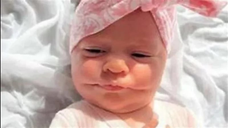 رضيعة تصاب بمتلازمة تجعلها مبتسمة دائمًا