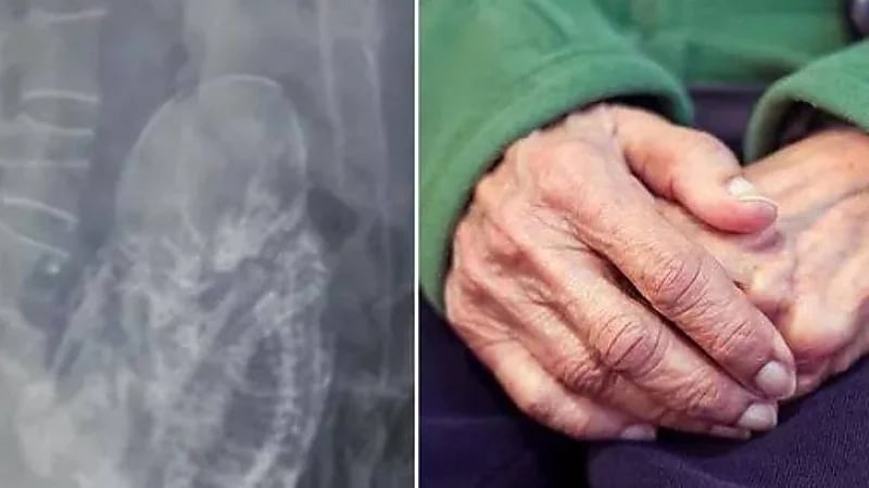 عجوز عمرها 84 تحمل جنينًا عمره 40 عام