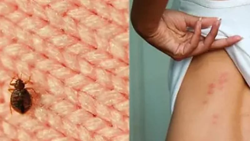3 علامات تدل على وجود بق الفراش في المنزل