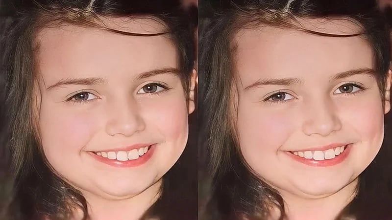 وفاة طفلة أمريكية بسبب إصابتها بقمل الشعر .. فيديو