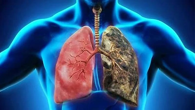 مقطع يحبس الأنفاس يكشف كيف تدمر السجائر الرئتين .. فيديو