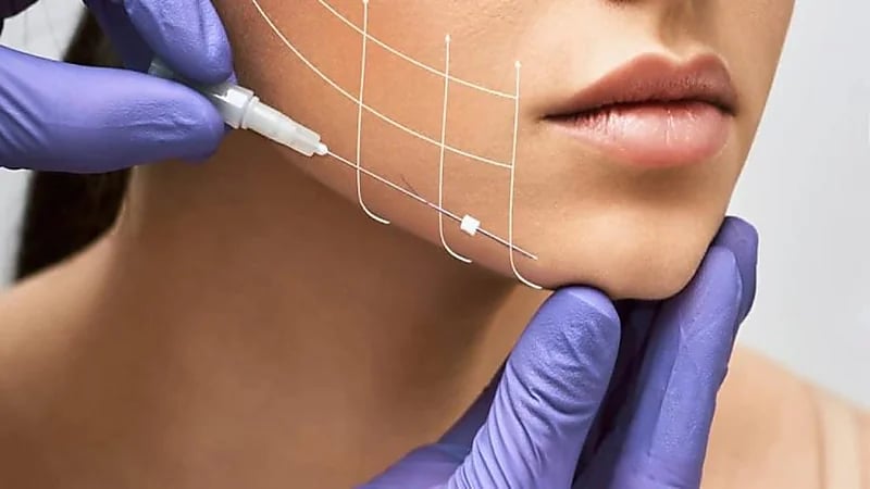 أشياء عليك معرفتها قبل إجراء شد الوجه