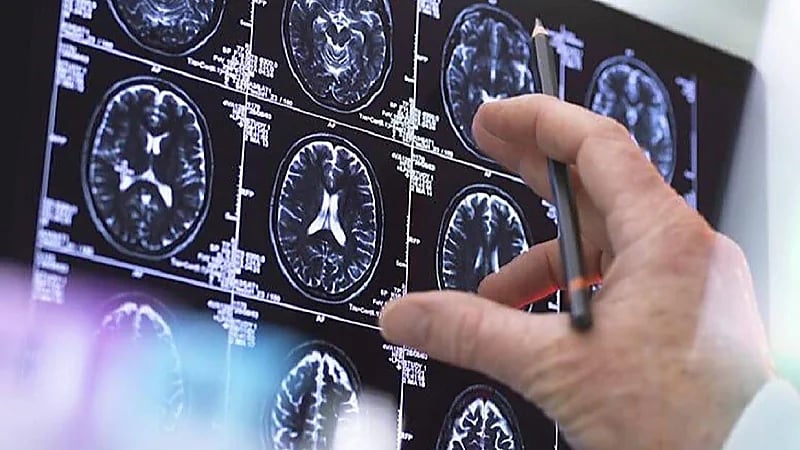 أخصائية أورام: الروائح الكريهة قد تشير لوجود ورم في الدماغ