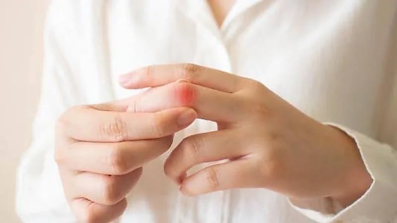 الكشف عن أبرز أسباب انتفاخ اليدين عند الاستيقاظ