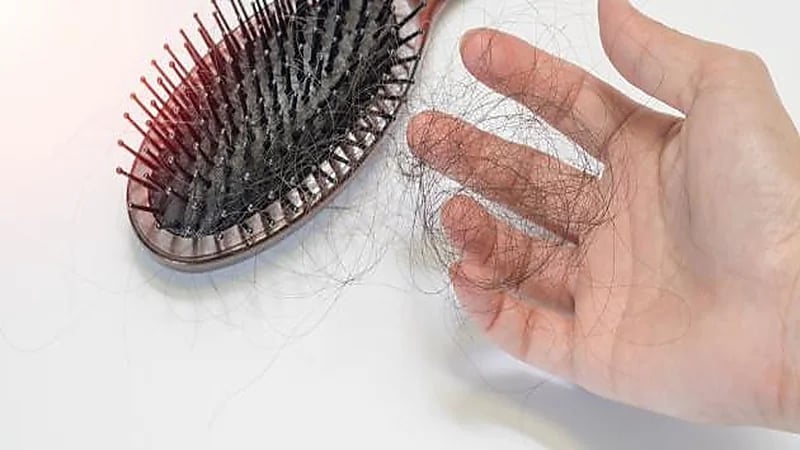 سبب تساقط الشعر في الخريف