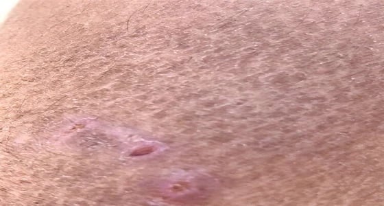 مقيم يتعرض للهجوم من 4 كلاب ضالة بمهد الذهب