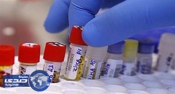 تفاصيل أحدث اختبارات الكشف عن فيروس «زيكا»