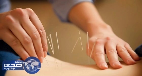 دراسة: الإبر اليابانية أدق وأفضل من الصينية