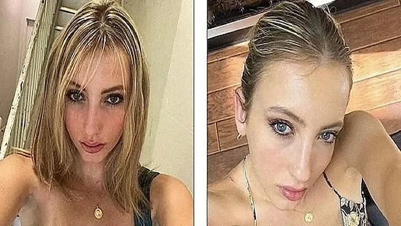 امرأة تكتشف أن قلبها على الجانب الأيمن بدلا من الأيسر