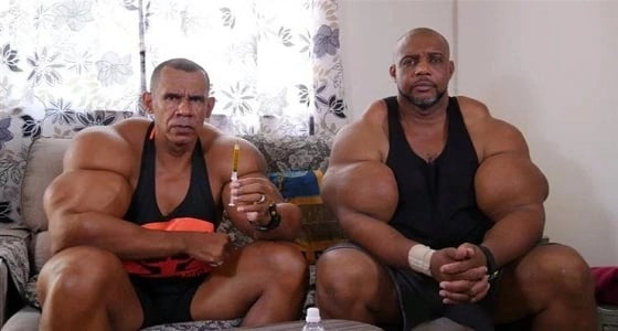 " هوس العضلات " .. شقيقان يحقنان جسديهما بعلاج الخيل والأبقار