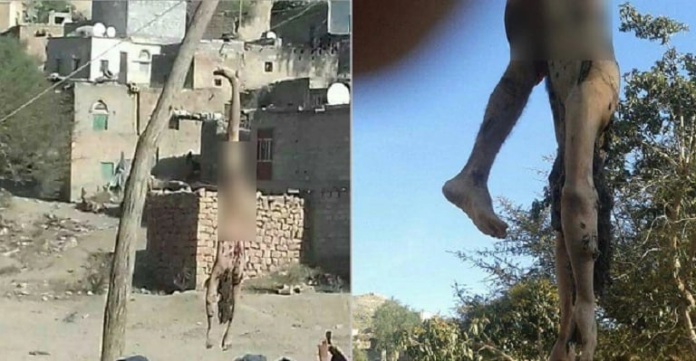 بالصور.. الحوثيون يذيقون مواطن يمني ألوان العذاب في إب