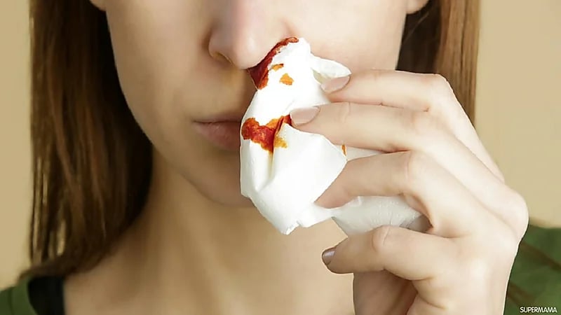 أسباب نزيف الأنف في الصيف والتصرف السليم