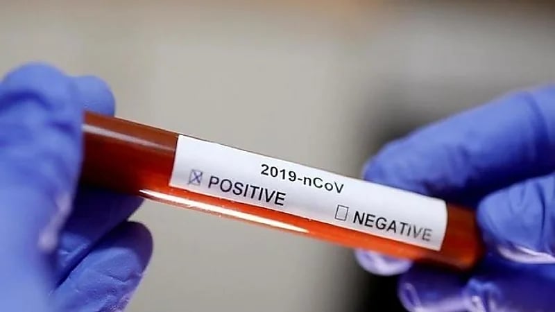 حقيقة العلاقة بين فصائل الدم وكورونا