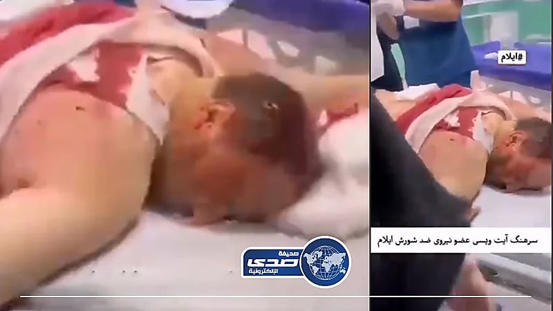 فيديو..إصابة جديدة في صفوف الحرس الثوري الإيراني واستقالات بالجملة