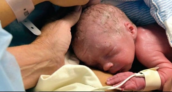 ولادة أول جنين من رحم مزروع في أمريكا