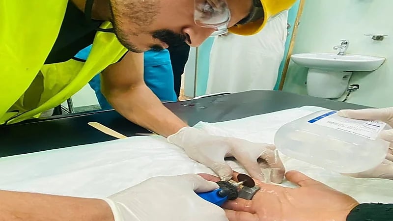 تحرير يد طفلة علقت في قطعة معدنية ببريدة