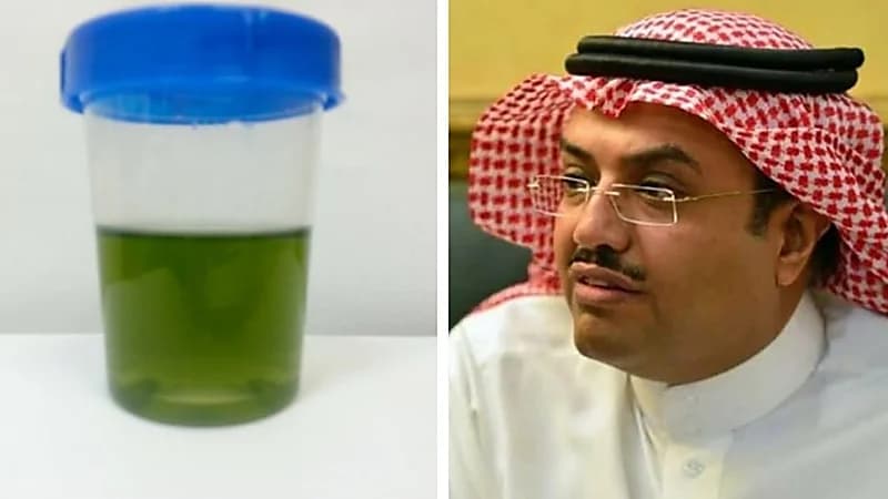 النمر يكشف عن سبب تغير لون البول إلى الأخضر