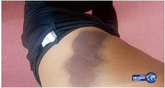 أب يعنف ابنته ويتهمها بالسحر والشعوذة.. و«أحوال مكة» تنزع منه حق الرعاية