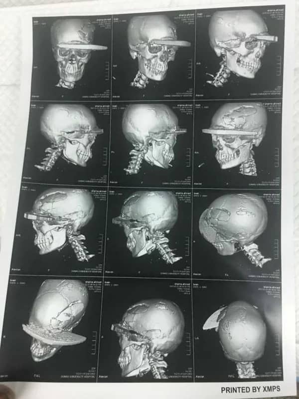 شاهد.. الحديثي يكشف عن طرق وآليات مواجهة ظاهرة التسول في شهر رمضان