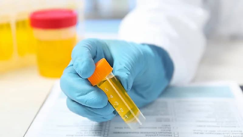 "سعود الطبية" تحذر من مخاطر إهمال زلال البول