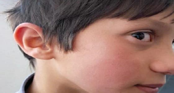 مدير مدرسة ابتدائية في أبها يعتدي على طالبين.. والجهات المختصة تحقق