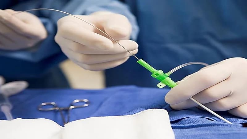 "قلبي" تنهي معاناة مسنة زائرة بـقسطرة تشخيصية خلال 3 أسابيع