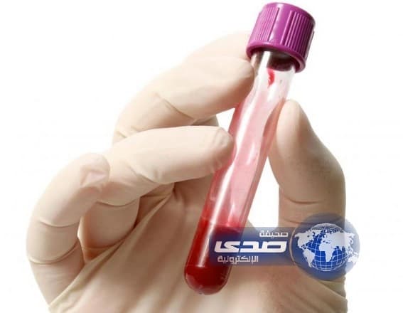 فحص للدم يحدد كم تبقى من العمر