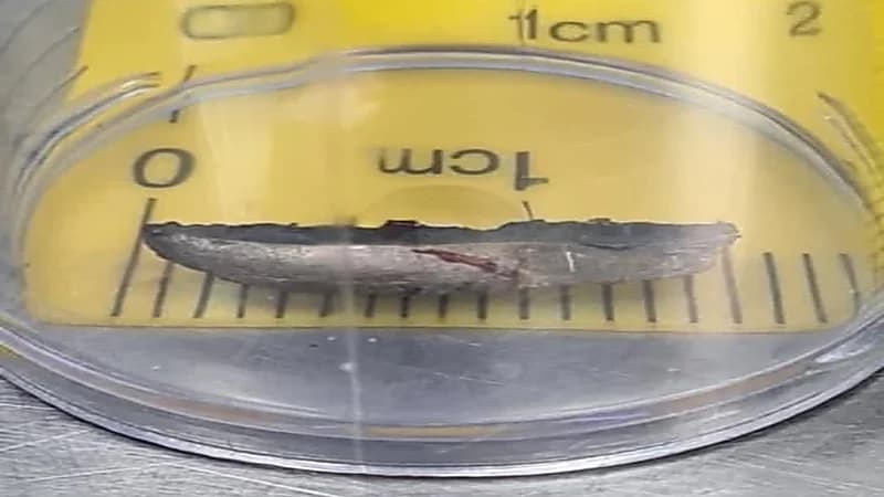 إنقاذ عين مقيم بعد اختراق أداة حديدية لها