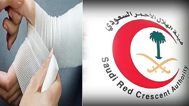 بالفيديو.. الهلال الأحمر يوضح خطوات إسعاف المصابين بالحروق