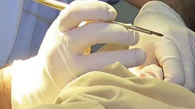 وفاة 23 فتى في حفل ختان