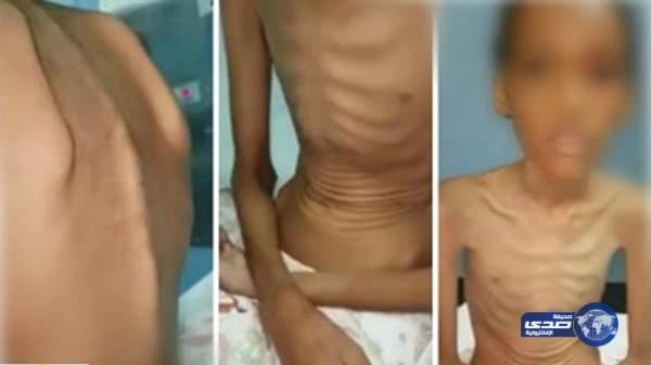 والدة أطفال خيبر تنفي تعذيبهم وحرمانهم من الأكل ..وتؤكد إضرابهم عن الطعام من تلقاء نفسهم