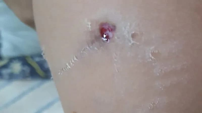 رئيس بلدية تيماء يطمئن على طفل هاجمته كلاب ضالة